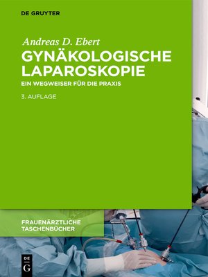 cover image of Gynäkologische Laparoskopie